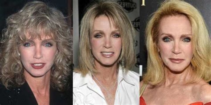 Just As Young In Her 80s, Donna Mills’s Cosmetic Surgery Has Stunned Many!