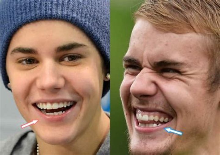 Has Justin Bieber Ever Had Braces?
