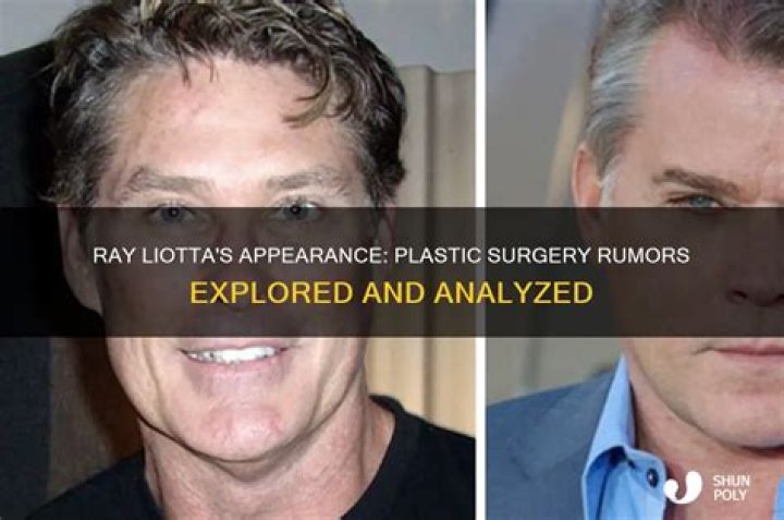 Has Ray Liotta Had Plastic Surgery?